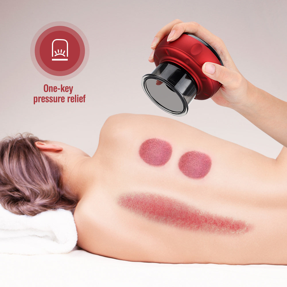 Electric Vacuum Cupping Massager – Anti-Cellulite Therapy & Fat Burning